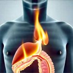 What Causes That Burning Sensation Without Eating Anything?