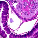 What gut markers change under chronic stress