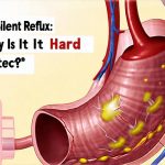What Is Silent Reflux and Why Is It Hard to Detect?