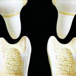 What to expect from a comprehensive stool analysis