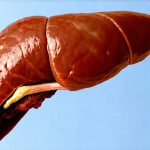 When a liver scan is more useful than a blood test