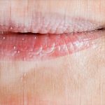 Which gut tests give clues about skin health