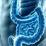 Why Fermentation in the Gut Causes Painful Pressure